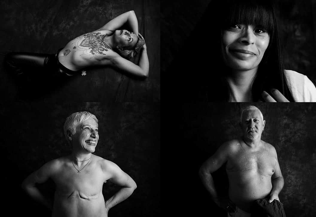 SU2C hosts powerful 'defiance' photo series hero banner.